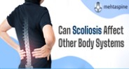 Can Scoliosis Affect Other Body Systems?