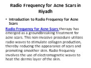 Radio Frequency for Acne Scars in Riyadh
