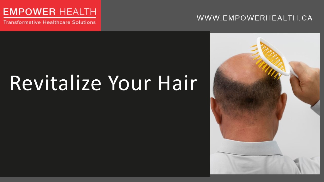 Revitalize Your Look with Hair Transplant in Vancouver (1)