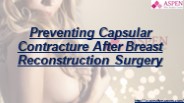 Preventing Capsular Contracture After Breast Reconstruction Surgery