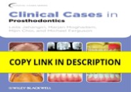 (PDF/DOWNLOAD) Clinical Cases in Prosthodontics