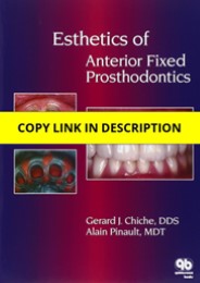 (PDF) Esthetics of Anterior Fixed Prosthodontics Android