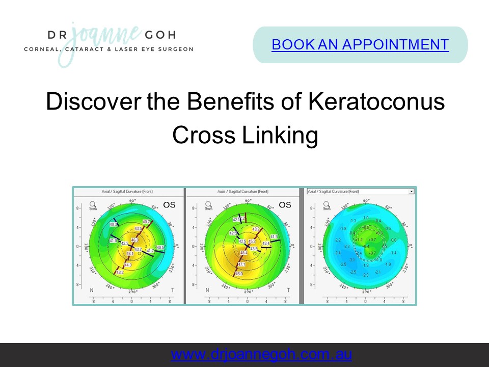 Discover the Benefits of Keratoconus Cross Linking