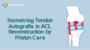 Hamstring Tendon Autografts in ACL Reconstruction by Pristyn Care