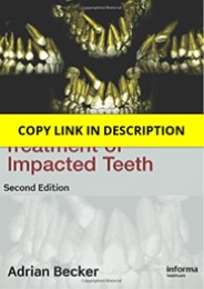 (PDF) Orthodontic Treatment of Impacted Teeth,Second Edition 2nd Edition Full