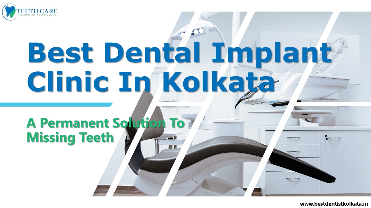 Best Dental Implant Clinic In Kolkata A Permanent Solution To Missing Teeth