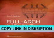 Read [PDF] Full-Arch Implant Rehabilitation
