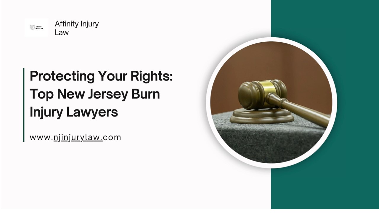 Protecting Your Rights: Top New Jersey Burn Injury Lawyers