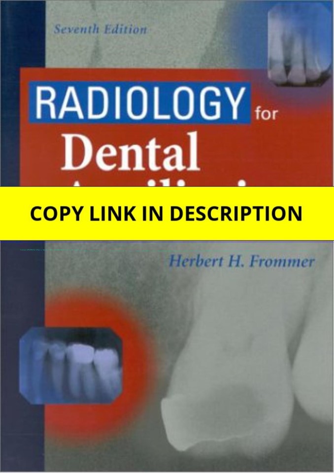 (PDF) Radiology for Dental Auxiliaries     7th Edition Kindle