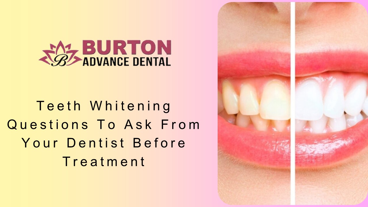 Teeth Whitening Questions To Ask From Your Dentist Before Treatment