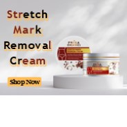 Stretch Mark Removal Cream | Prisa Organics