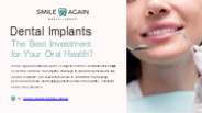 Dental Implants: The Best Investment for Your Oral Health?
