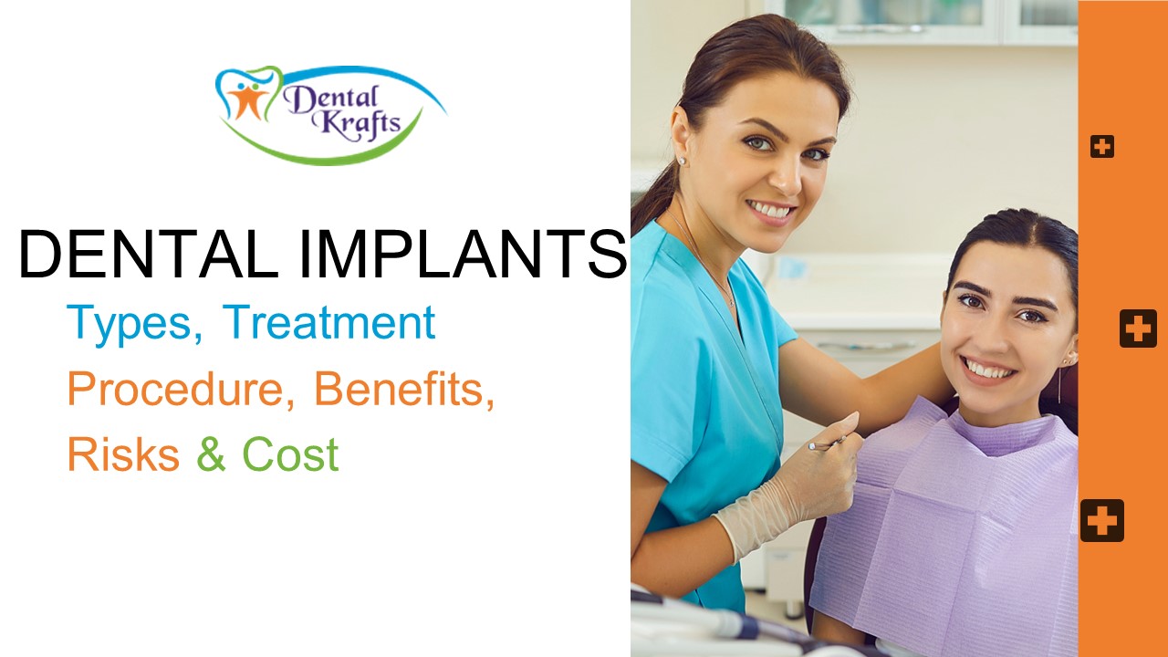 dental implants: types, treatment procedure, benefits, risks & cost
