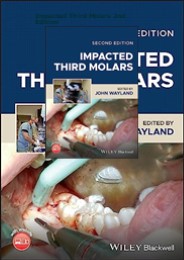 Pdf⚡️(read✔️) Impacted Third Molars 2nd Edition