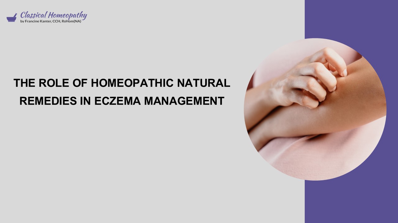 The Role of Homeopathic Natural Remedies in Eczema Management