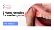 5 Home remedies for swollen gums