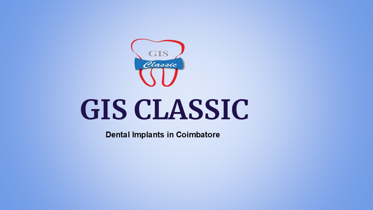 Dental Implants in Coimbatore | Implant Dentistry Coimbatore
