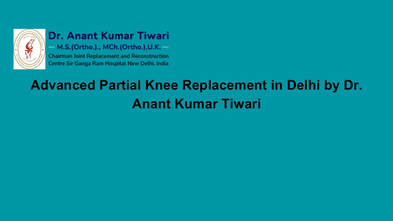 Partial Knee Replacement Surgery Delhi | Dr. Anant Kumar Tiwari