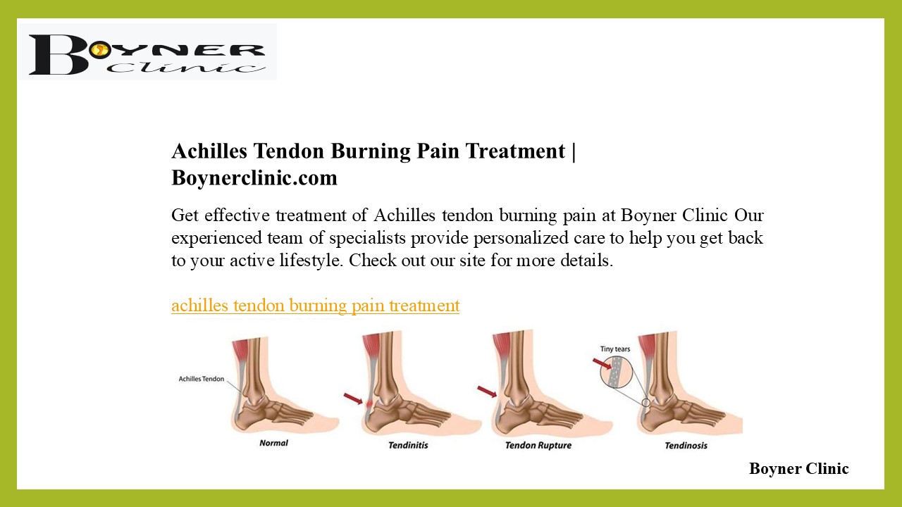 Achilles Tendon Burning Pain Treatment | Boynerclinic.com