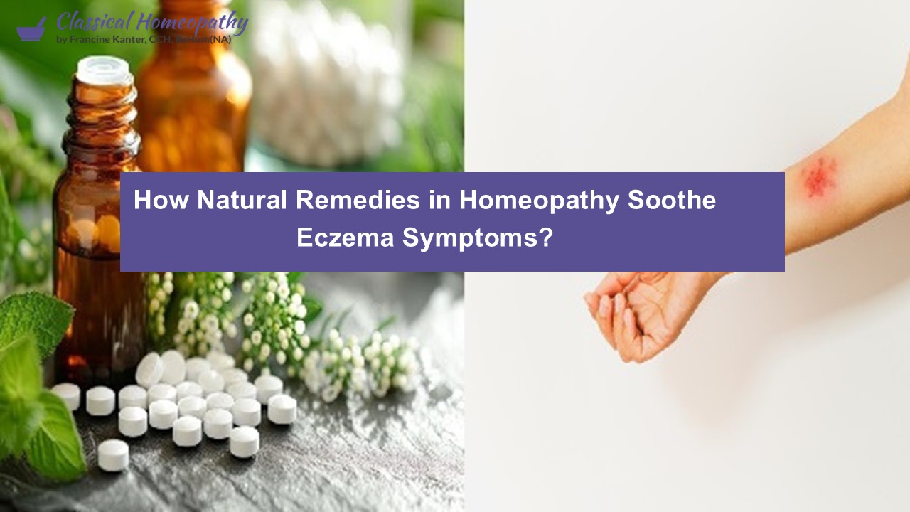 How Natural Remedies in Homeopathy Soothe Eczema Symptoms?