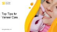 Top Tips for Veneer Care