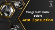 Things to Consider Before Arm Liposuction