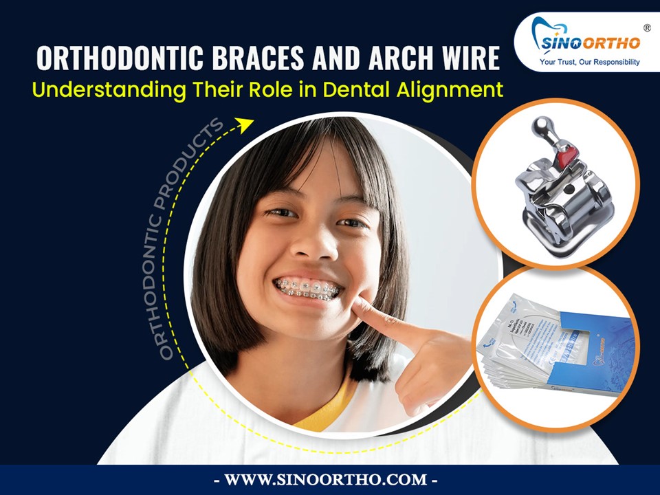 Orthodontic Braces and Arch Wire: Understanding Their Role in Dental Alignment