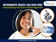Orthodontic Braces and Arch Wire: Understanding Their Role in Dental Alignment