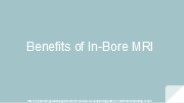 Benefits of In-Bore MRI Tech for Patients