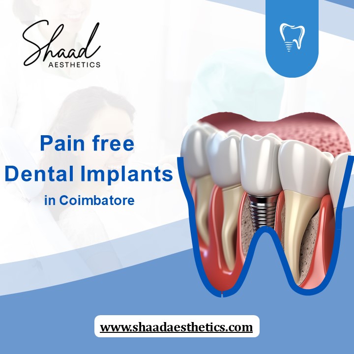 Pain free Dental Implants