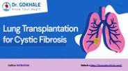Cystic Fibrosis: Complications &amp; Lung Transplantation as Treatment