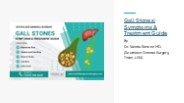 Gall Stones: Symptoms & Treatment Guide