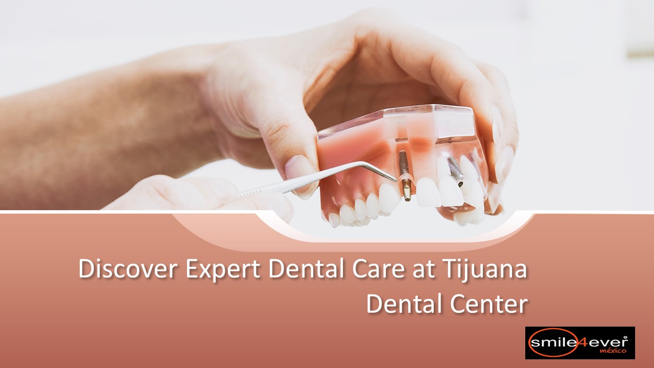 Discover Expert Dental Care at Tijuana Dental Center