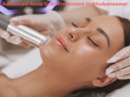 Advanced Acne Scar Treatment in Bhubaneswar