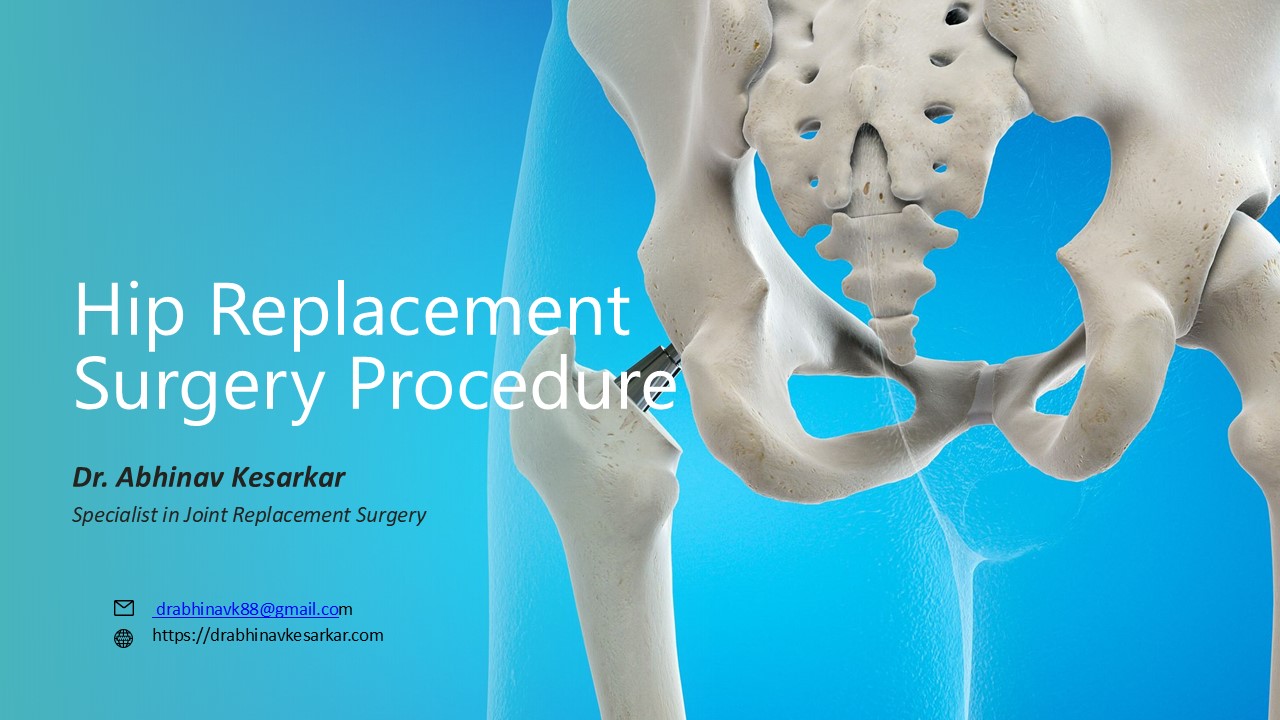 Hip Replacement Surgery Procedure- Dr Abhinav Kesarkar (1)