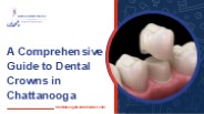 A Comprehensive Guide to Dental Crowns in Chattanooga