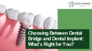Deciding Between Dental Bridge and Implant: Your Best Choice