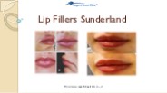 Lip Fillers Sunderland