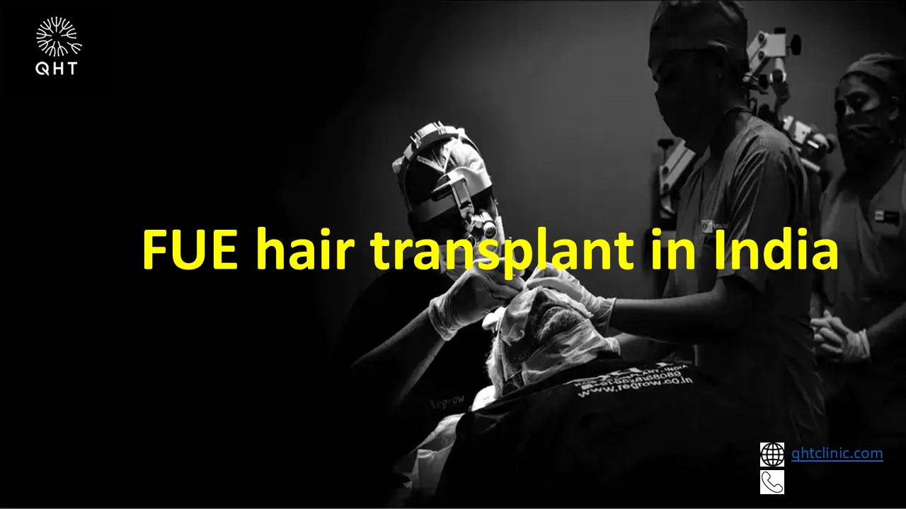 FUE Hair Transplant Cost