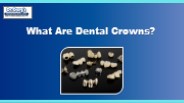 What Are Dental Crowns?