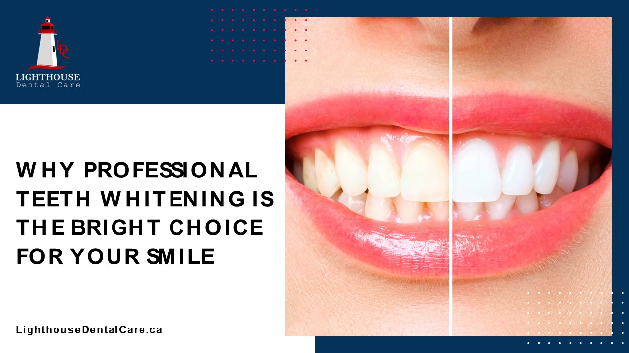 Why Professional Teeth Whitening Is the Bright Choice for Your Smile