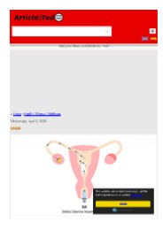 What is the Best IUI Treatment Center in Delhi?