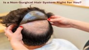 Is a Non-Surgical Hair System Right for You
