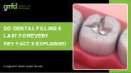Understanding Dental Fillings: What Lasts and When to Replace