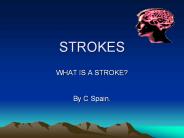 Strokes