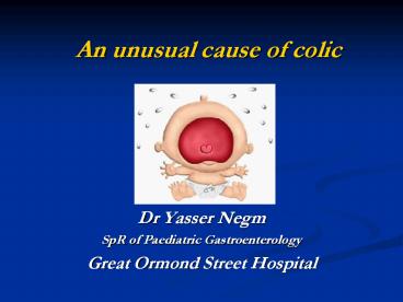 An unusual cause of colic