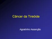 Cancer da tireoide