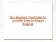 Non Invasive Treatment for Cellulite Skin PowerPoint PPT Presentation