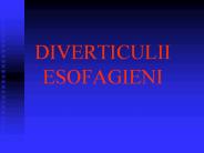 diverticuli esofagieni, acalazia
