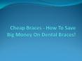 Cheap Braces - How to Save Big Money on Dental Braces